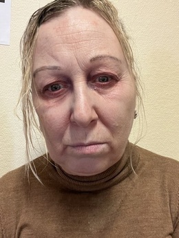 Vaka filminspelning Vaka filminspelning