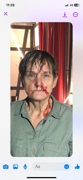 Fra TV serien Dumbie