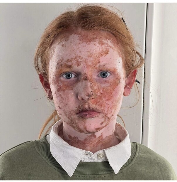 Filmopptak «Det er tøft å være Iben» Filmopptak «Det er tøft å være Iben»