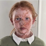 Filmopptak «Det er tøft å være Iben» Filmopptak «Det er tøft å være Iben»