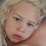 To forskjellige øyner -25 To forskjellige øyner -25