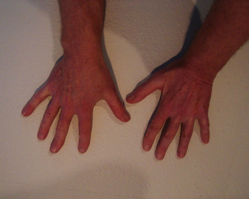 Händer