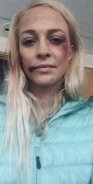 Når det blir blodig på sett