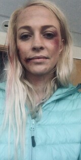 Når det blir blodig på sett