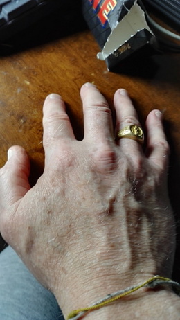 handbild1 handbild1