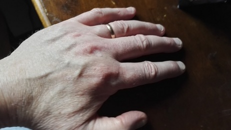 handbild5 handbild5
