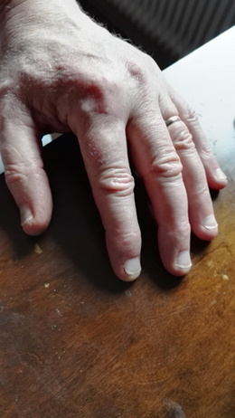 handbild6 handbild6
