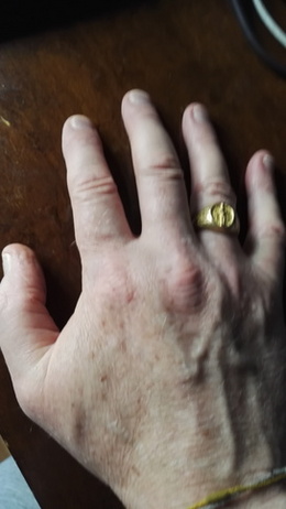 handbild10 handbild10