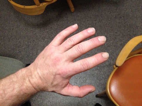 hand