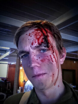 skadet soldat skadet soldat