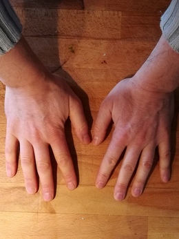 Händer 1 Händer 1