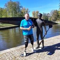 Benproteser finns flera olika sorters. H